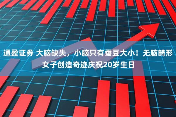通盈证券 大脑缺失，小脑只有蚕豆大小！无脑畸形女子创造奇迹庆祝20岁生日
